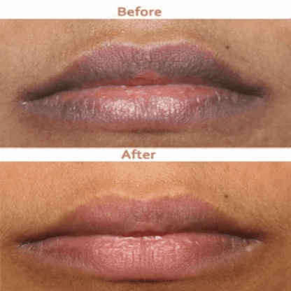 Plumping & Moisturising Lip Serum – Hydrating Anti-Wrinkle Lip Care
