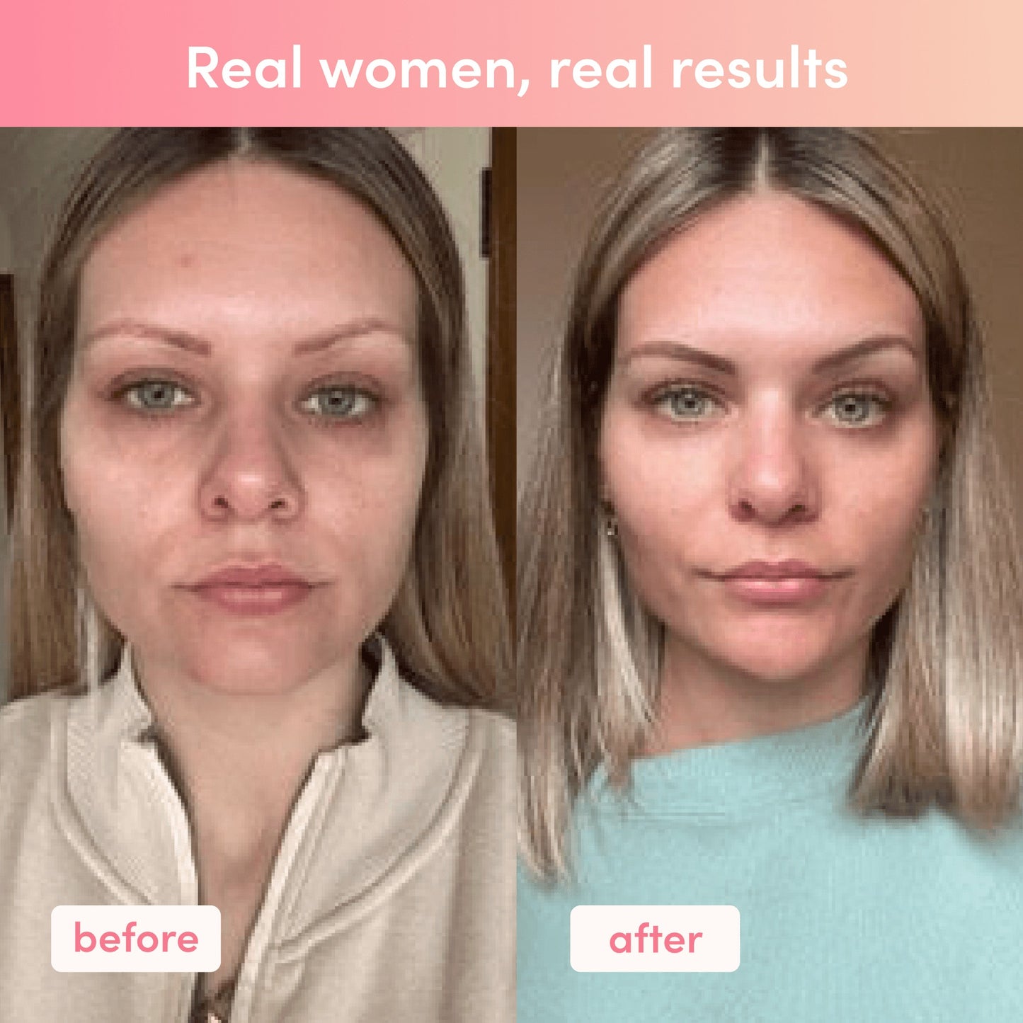 Collagen Peptide Capsules – 240 Capsules Skin & Joint Support