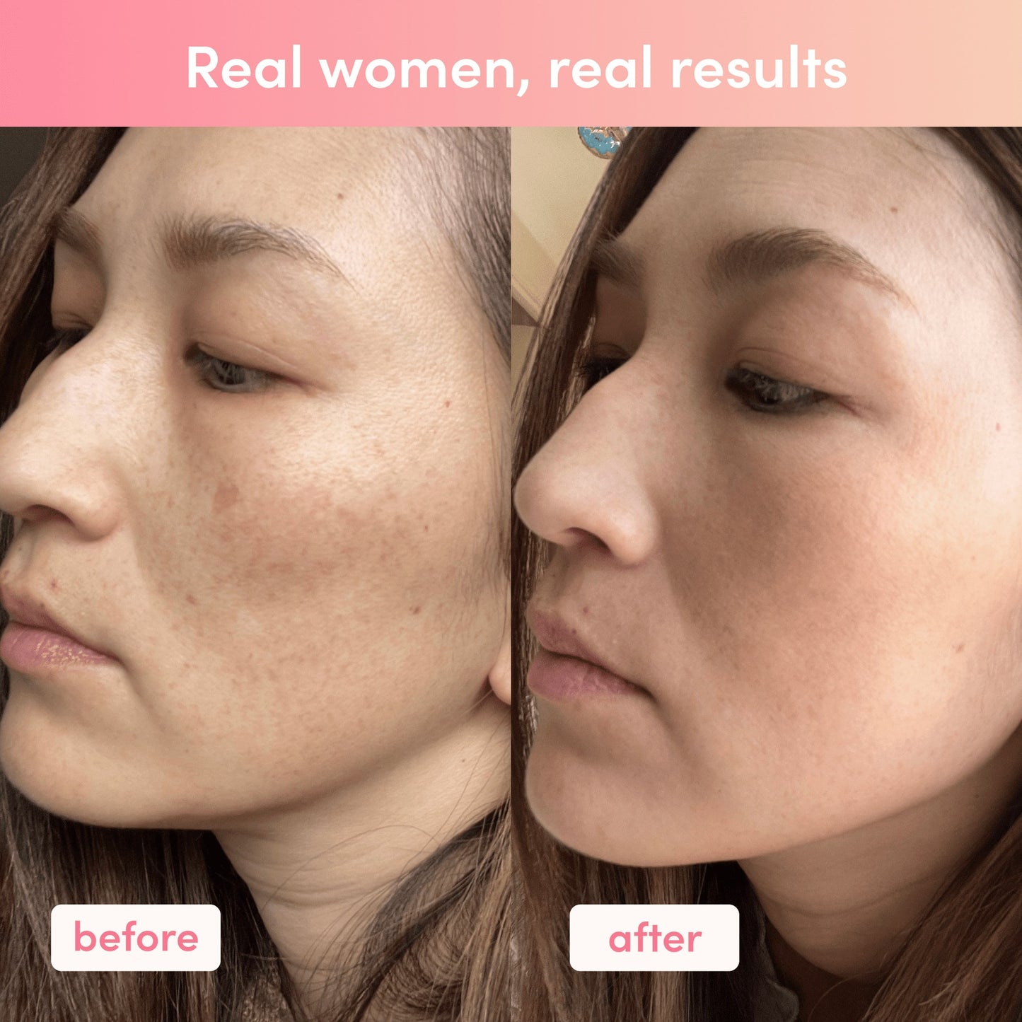 Collagen Peptide Capsules – 240 Capsules Skin & Joint Support
