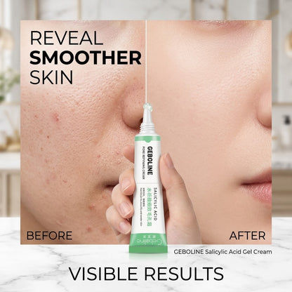 Salicylic Acid Facial Gel Cream – Lightweight Gel for Smooth Skin