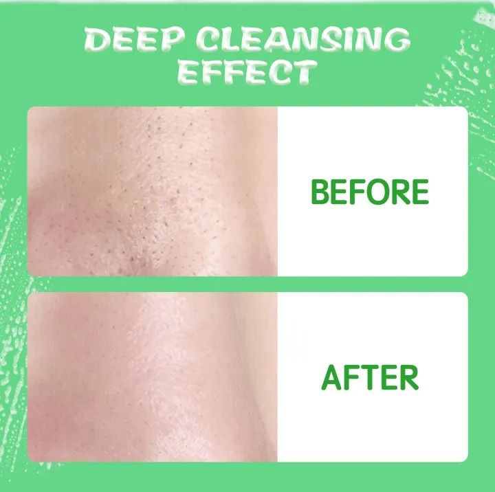 Hyaluronic Acid & BHA Facial Cleanser Korean Face Wash