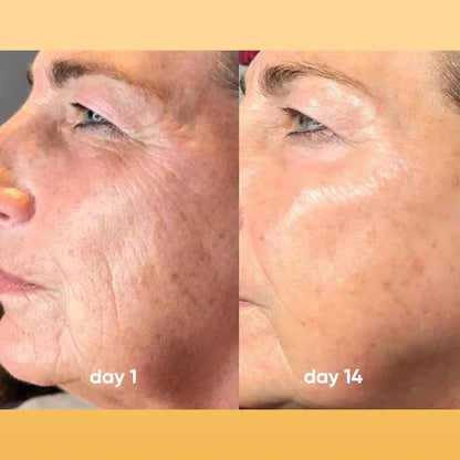 Exfoliating Turmeric Kojic acid pads - Reveal Your Radiant Skin