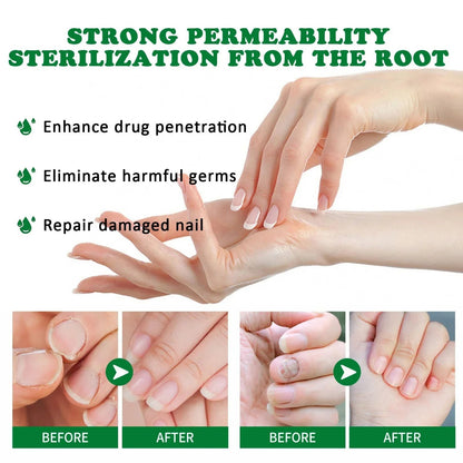 FungiFree™ Bee Venom Nail Treatment Serum