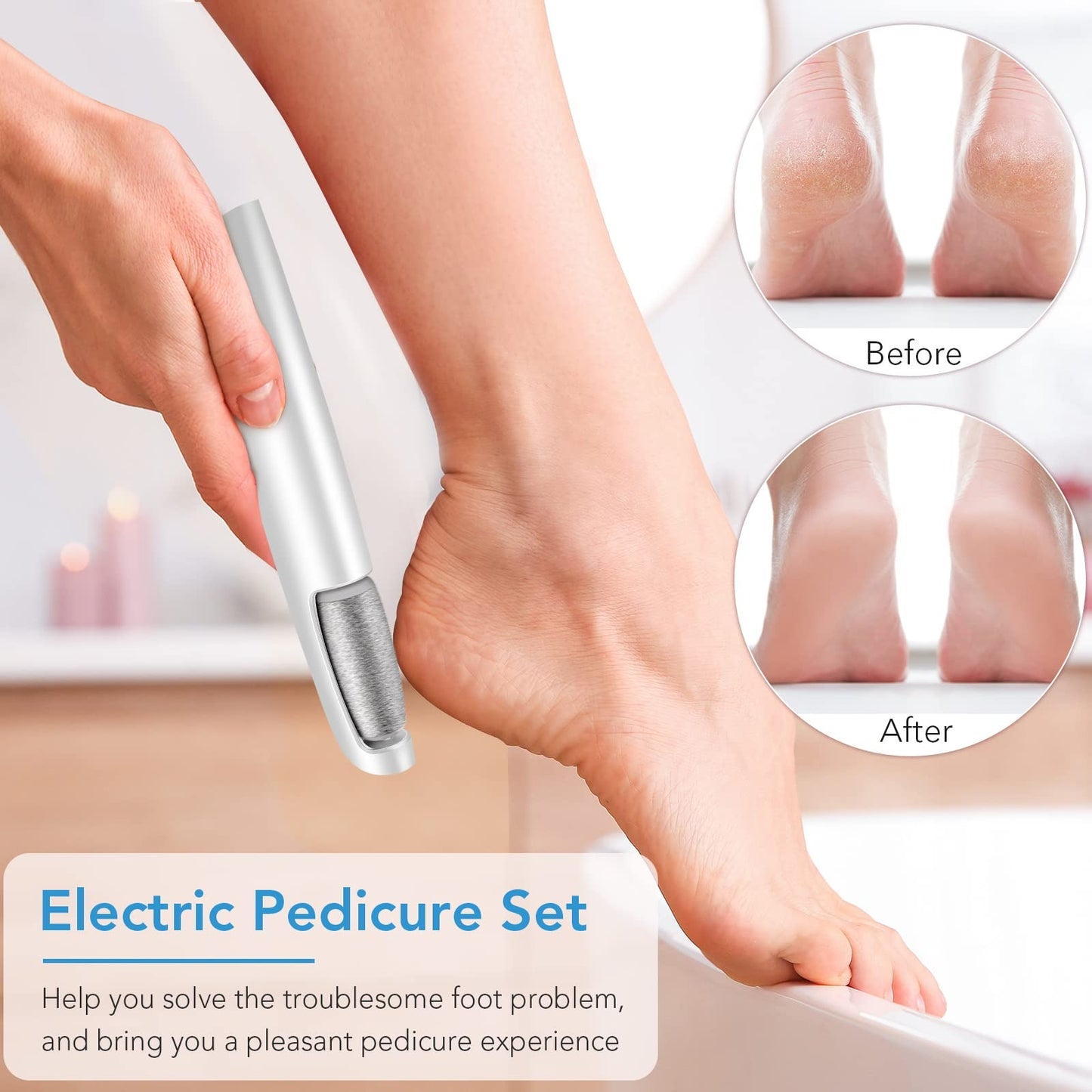 Rechargeable Electric Callus Remover