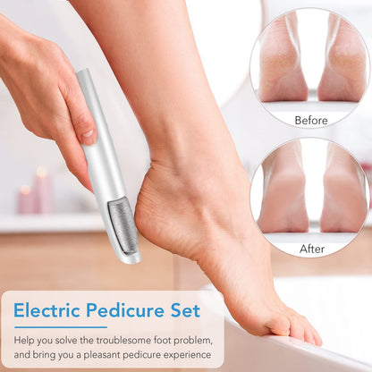 Rechargeable Electric Callus Remover