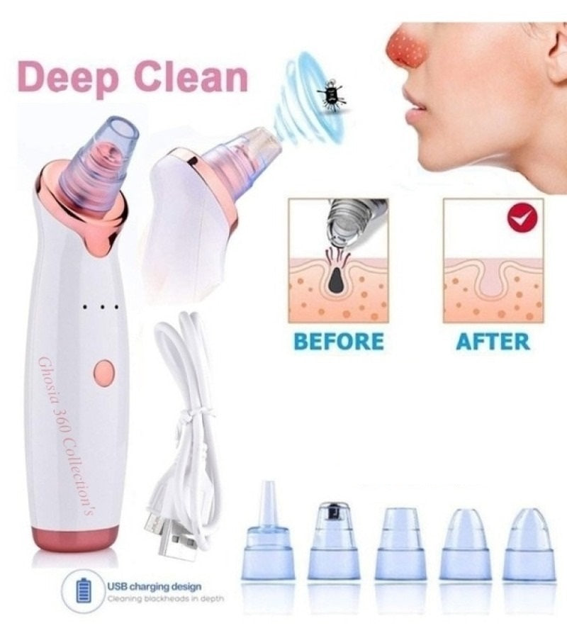Vacuum Blackhead Remover – Gentle Pore Cleansing Facial Tool