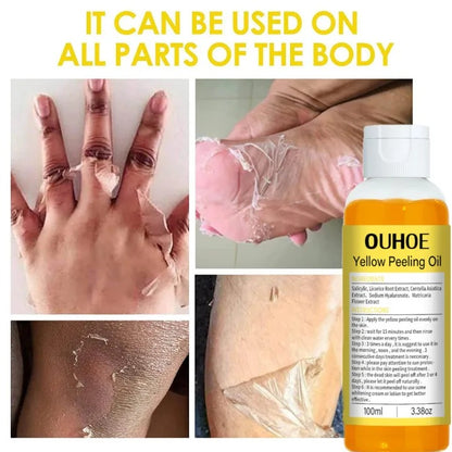 Reveal Radiant Skin — Yellow Peel Oil Treatment 🍋