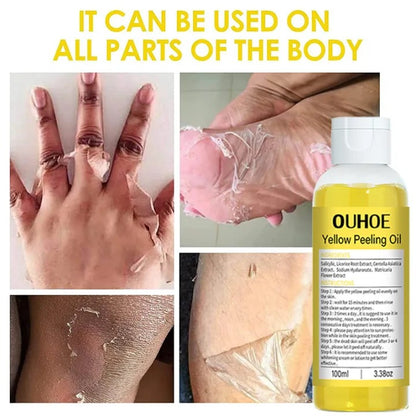 Body Yellow Exfoliating Oil – Brightening & Moisturizing Body Care (100ml)