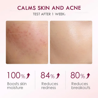 Hydrating Gel Cream – Hyaluronic Acid & Ceramide Facial Moisturizer