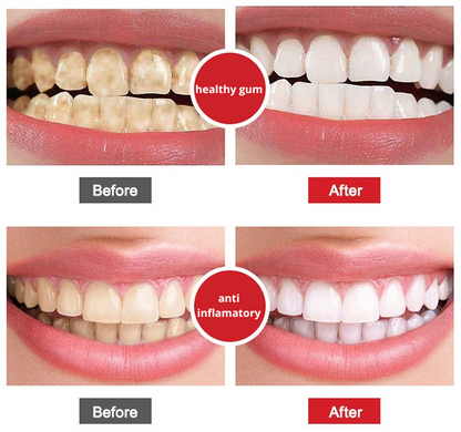 DentiZen™ Gum Regrowth Drops