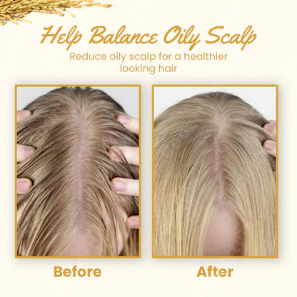 Ceoerty™ Hair Growth Rice Water