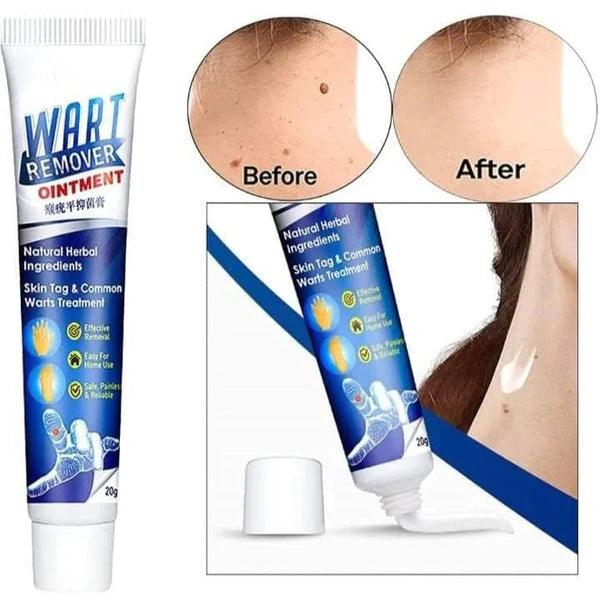 Wart Instant Blemish Cream