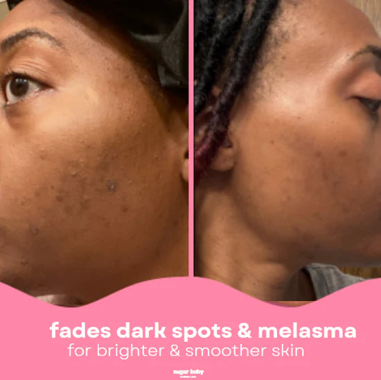 Turmeric Kojic Exfoliating Pads – Brighten, Smooth & Renew Skin Instantly