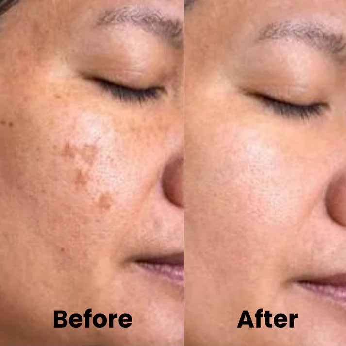 Turmeric Kojic Exfoliating Pads – Brighten, Smooth & Renew Skin Instantly
