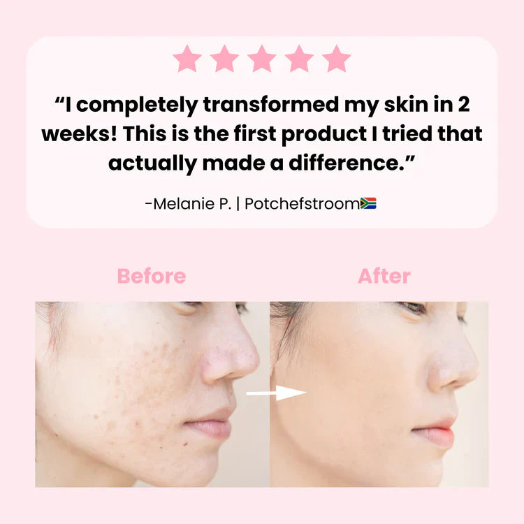Exfoliating Turmeric Kojic Acid Pads