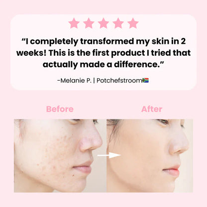 Exfoliating Turmeric Kojic Acid Pads