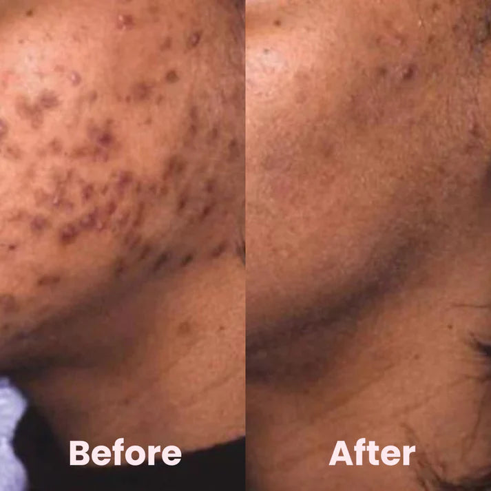 Exfoliating Turmeric Kojic Acid Pads