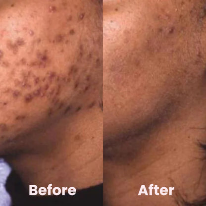 Exfoliating Turmeric Kojic Acid Pads