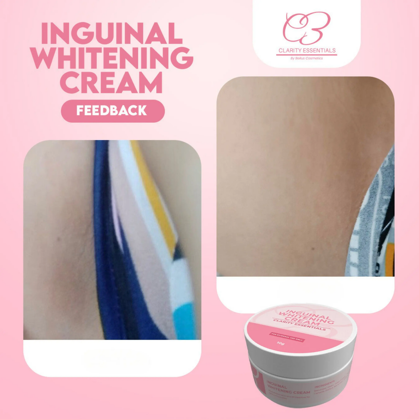 Intimate Area Brightening Cream – Daily Moisturizing & Skin Tone Care