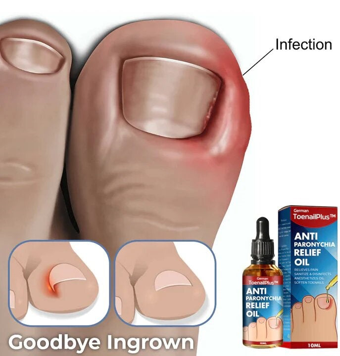 German ToenailPlus™ Anti Paronychia Relief Oil