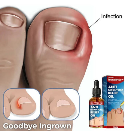German ToenailPlus™ Anti Paronychia Relief Oil