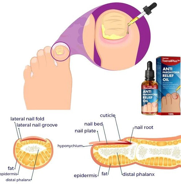 German ToenailPlus™ Anti Paronychia Relief Oil