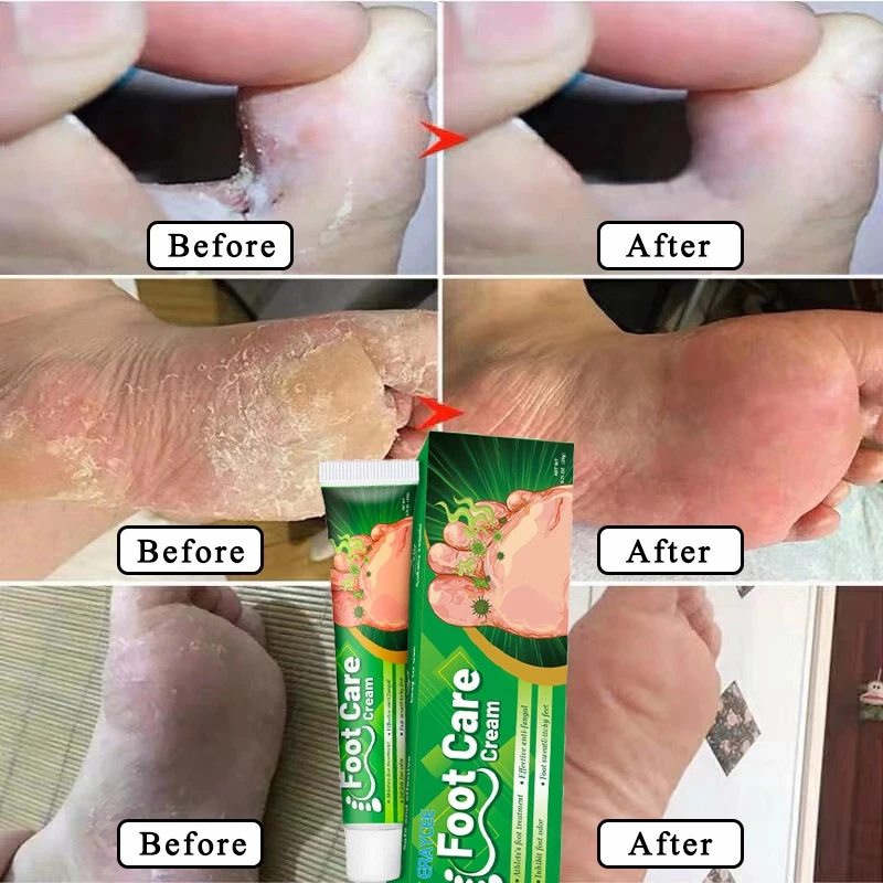 Orange Foot Odor Cream– Deodorizing & Soothing Foot Care