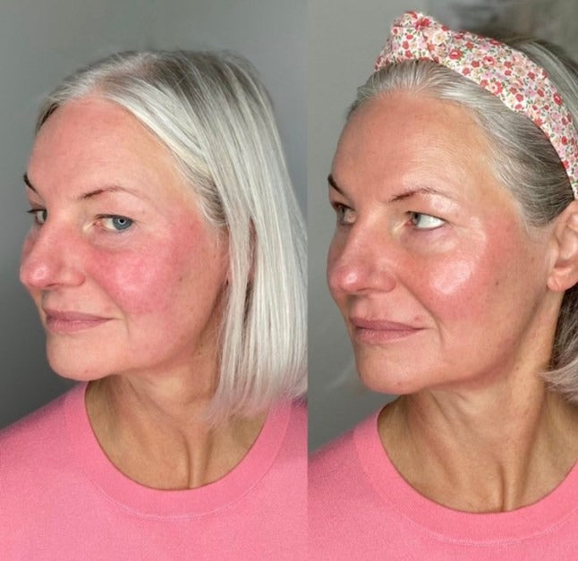 Retinol Body Lotion – Moisturizing Antioxidant Skincare