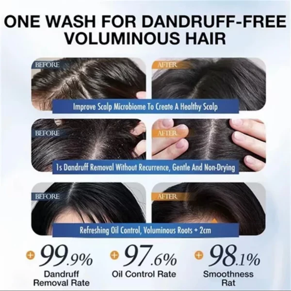 Anti Dandruff Shampoo – Scalp Care & Smooth Hair Cleansing Formula