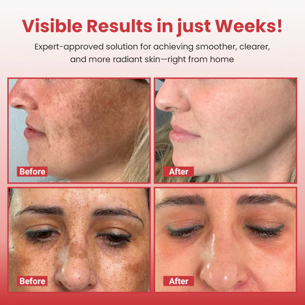 Hypochlorous Acid & Rice Peel Spray – Vitamin C Anti-Aging Exfoliating Mist
