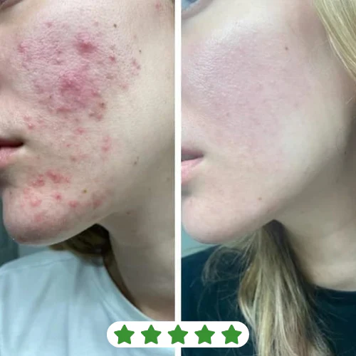 Purifying Green Tea Face Mask – Clean, Refresh & Oil Control Skin Care