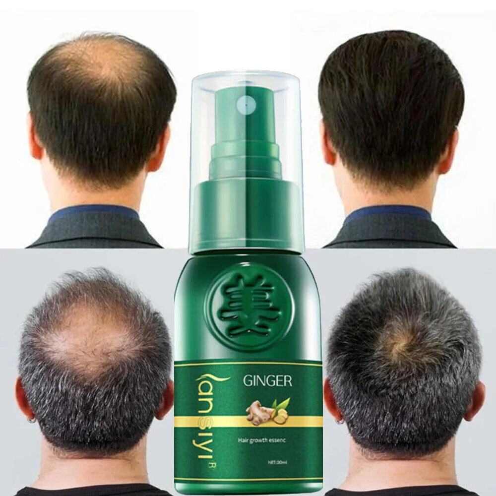 Biolab™ Japanese Hair Growth Spray