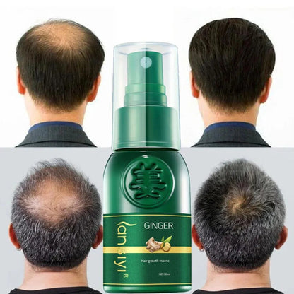 Biolab™ Japanese Hair Growth Spray