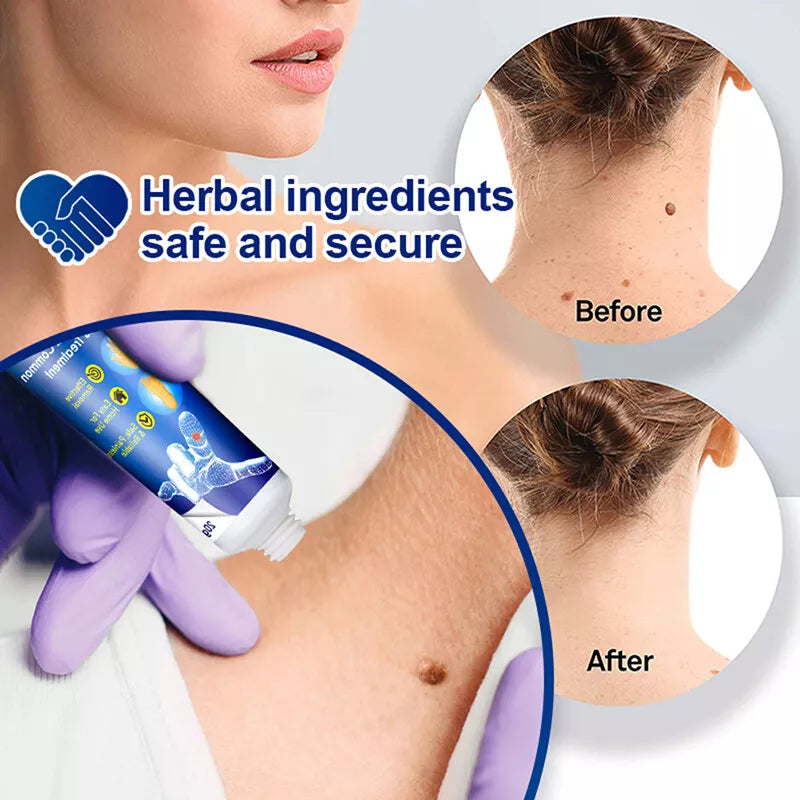 Wart Instant Blemish Cream Manufactured In Japan