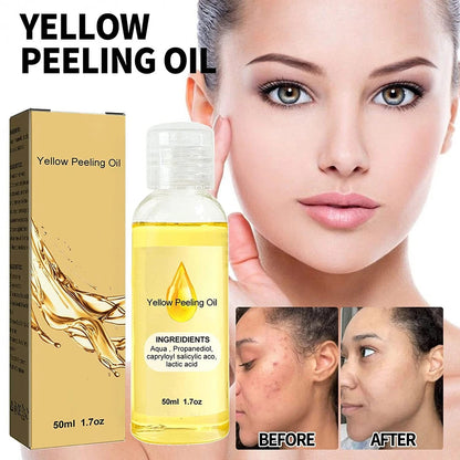 Reveal Radiant Skin — Yellow Peel Oil Treatment 🍋