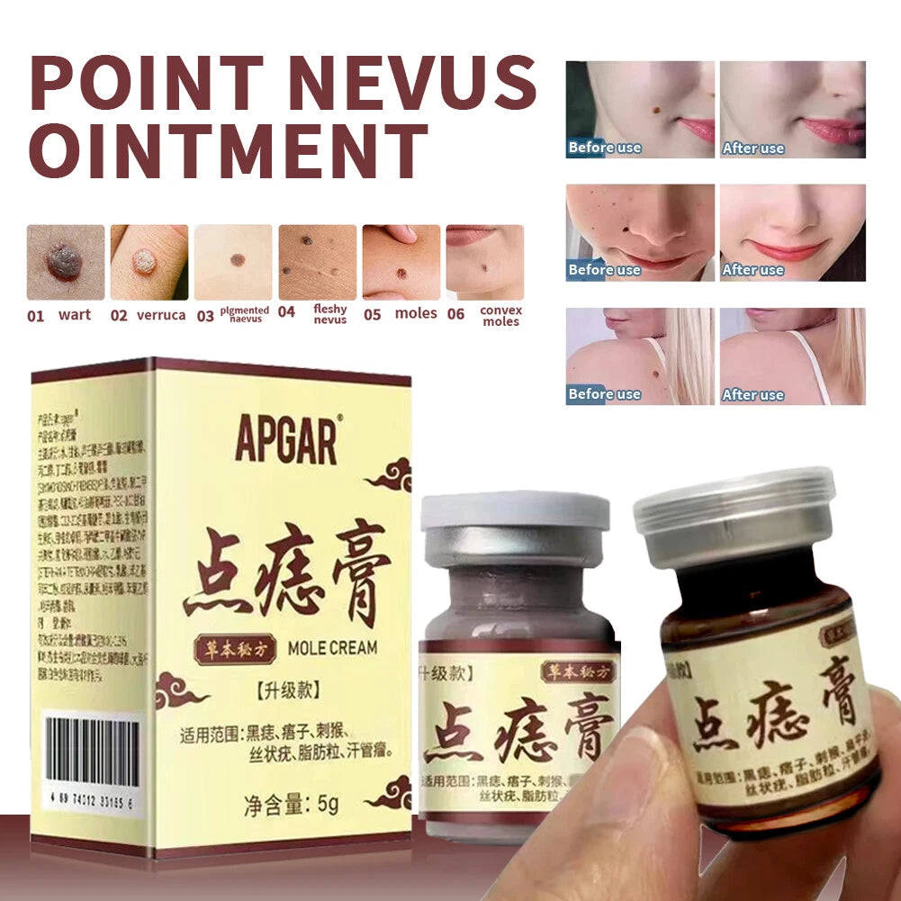 Mole and Spot Removal Cream
