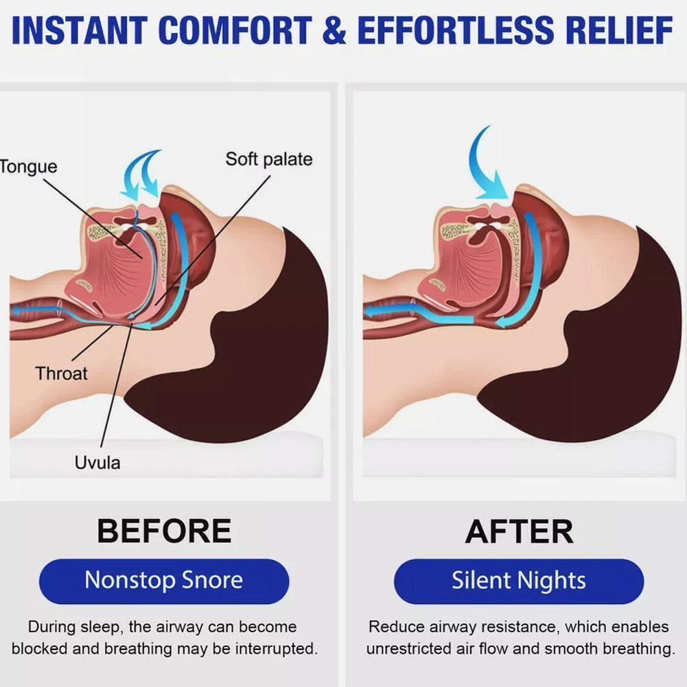 South Moon™ – Herbal Anti-Snoring Spray for Restful Sleep