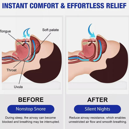 South Moon™ – Herbal Anti-Snoring Spray for Restful Sleep