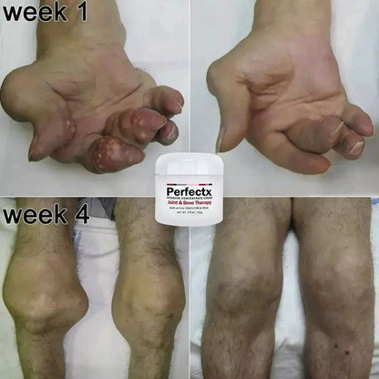 Perfectx Joint & Bone Therapy Cream