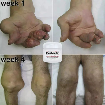 Perfectx Joint & Bone Therapy Cream