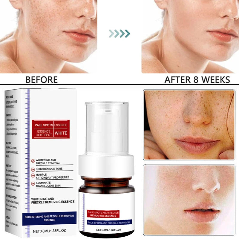 Vitamin C Cream – Brighten, Fade Dark Spots