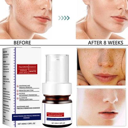 Vitamin C Cream – Brighten, Fade Dark Spots