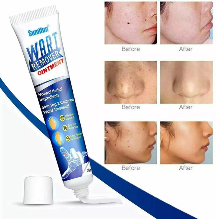 Wart Instant Blemish Cream