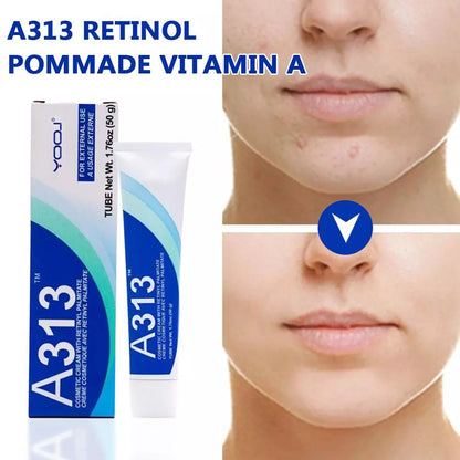 A313 Retinol Pommade Vitamin A Night Mousturizer