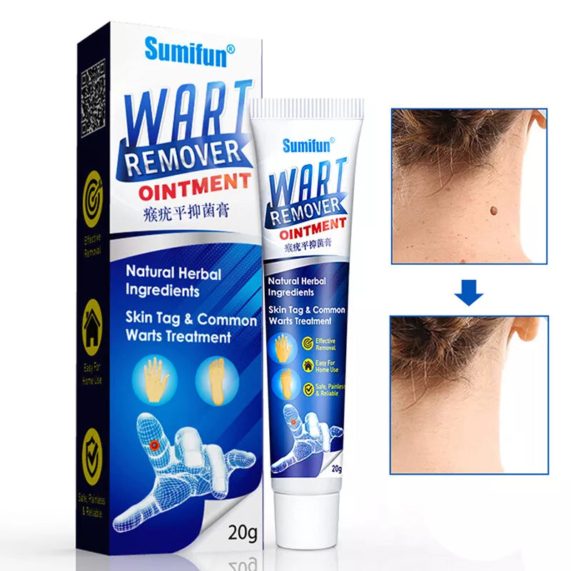 Wart Instant Blemish Cream Manufactured In Japan
