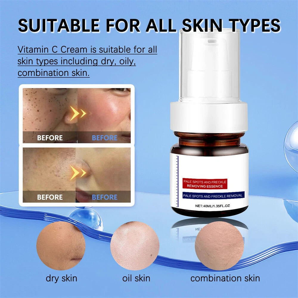 Vitamin C Cream – Brighten, Fade Dark Spots
