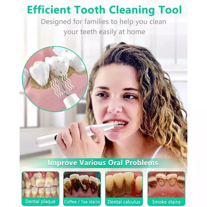 Portable Ultrasonic Tooth Cleaner – Safe & Effective Oral Care