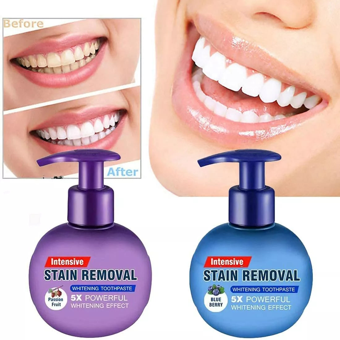 Intensive Stain Removal Whitening Toothpaste