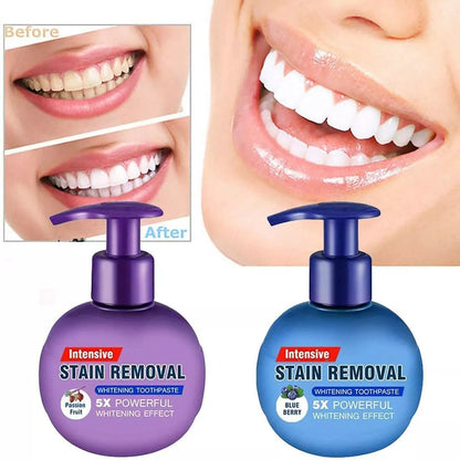 Intensive Stain Removal Whitening Toothpaste