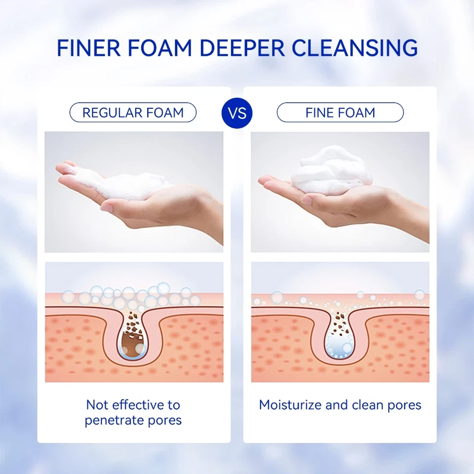Vitamin C Facial Cleanser – Deep Cleansing Acne Care Face Wash